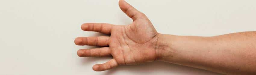 Palm